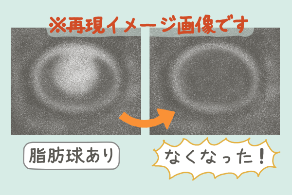 超音波検査の再現イメージイラスト